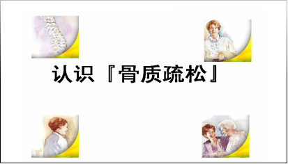 【双能X线骨密度检测，为健康加“骨”劲】我院引进法国MEDILINK公司的Medix90双能X线骨密度仪